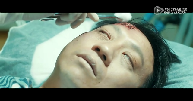 支点1